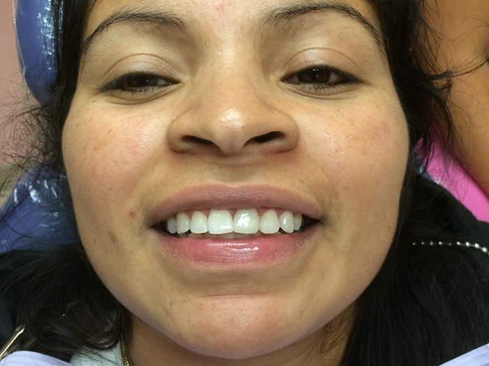 Cosmetic Dentistry Before and After